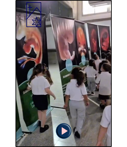 Ver Video